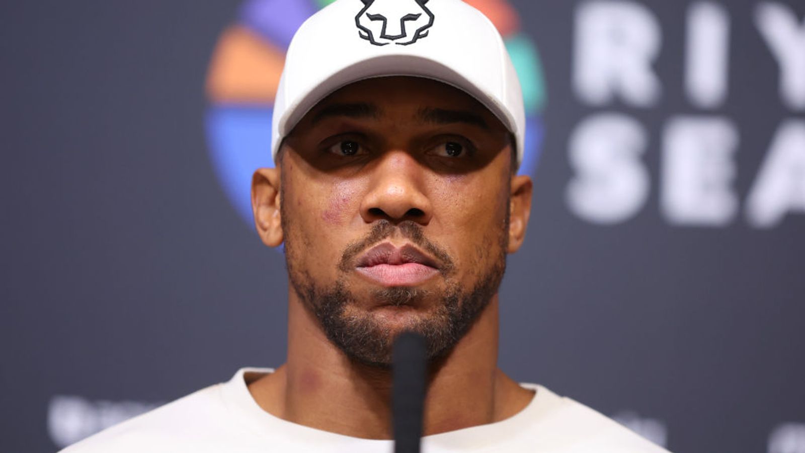 Anthony Joshua needs elbow surgery, boxing return delayed amid Tyson Fury fight speculation | Boxing News