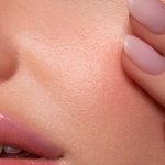 Breakouts After Facials Are More Common Than You Think – Here's Why