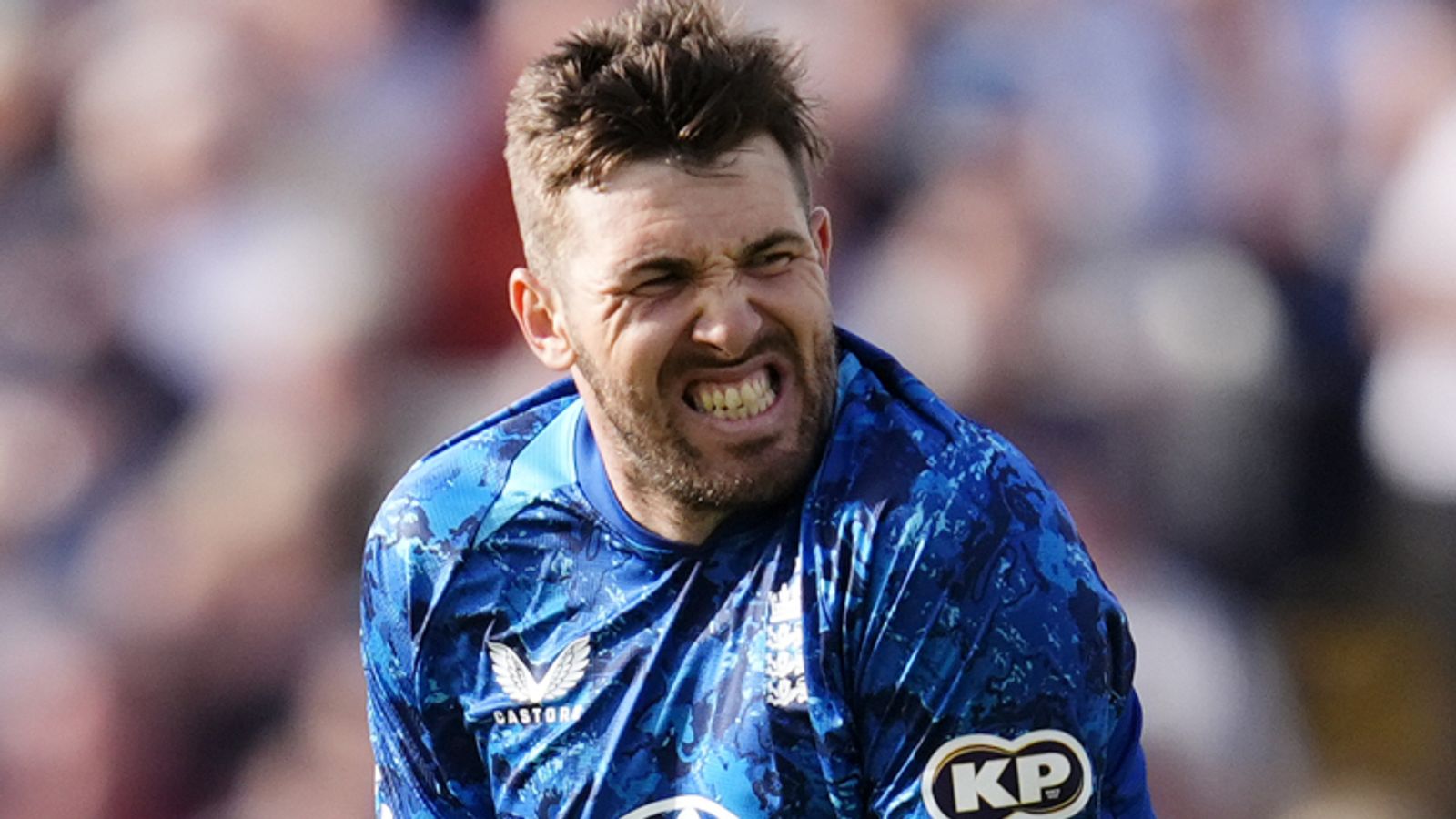 England vs West Indies: Matthew Potts drafted in for second ODI after Jamie Overton ruled out of white-ball series with broken little finger | Cricket News