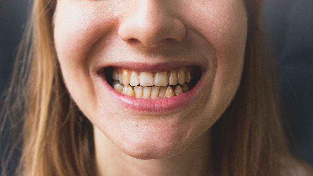 What is ‘Ozempic Teeth’? The Truth About the Weight Loss Treatment’s ‘Damaging’ Side Effects