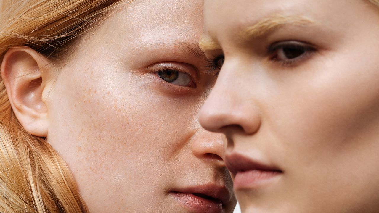 The Hollywood Dose: How Your Favorite Celebs Take Accutane